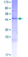 Human RHBDD2 Protein (Recombinant GST)