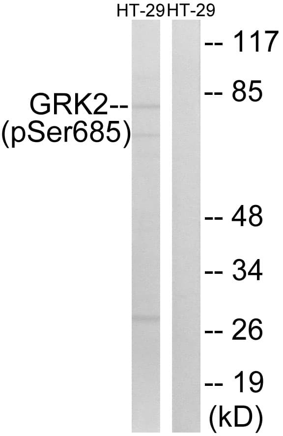 ADRBK1 / GRK2 Antibody (phospho-Ser685)