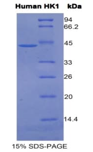 Human HK1 / Hexokinase 1 Protein (Recombinant His-GST)