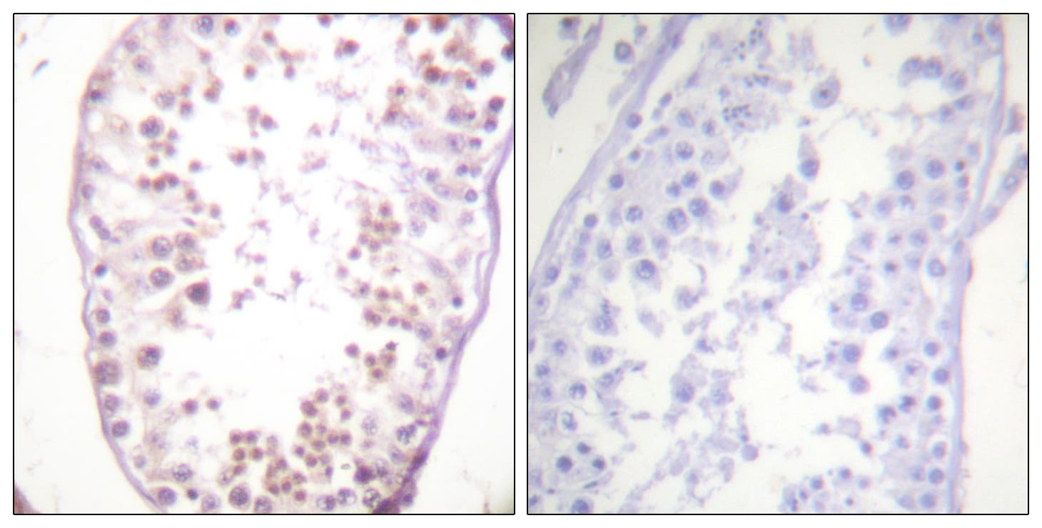 HDAC6 Antibody (phospho-Ser22)