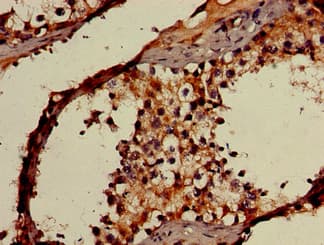 OAS3 / p100 Antibody