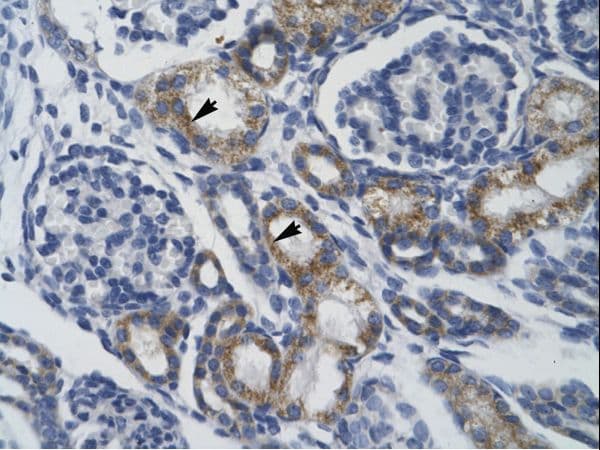 TRIM68 Antibody (aa279-328, HRP)