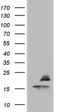 Monoclonal Mouse anti-Human PPIL1 Antibody (clone OTI2F1, WB)