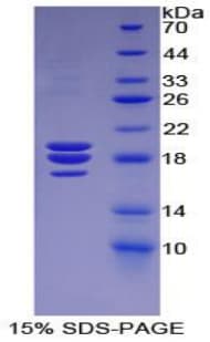 Dog F8 / FVIII / Factor VIII Protein (Recombinant His)