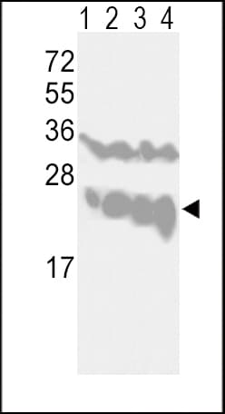 UCHL1 / PGP9.5 Antibody (aa16-46)
