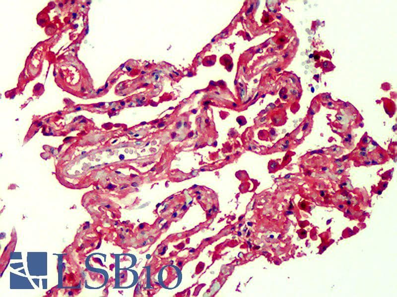 IHC-plus™ AGER / RAGE Antibody (clone DD/A11, Cy3)
