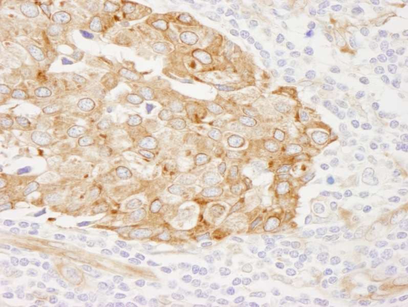 RCN1 / Reticulocalbin 1 Antibody (aa1-75)