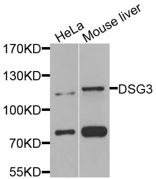 DSG3 / Desmoglein 3 Antibody