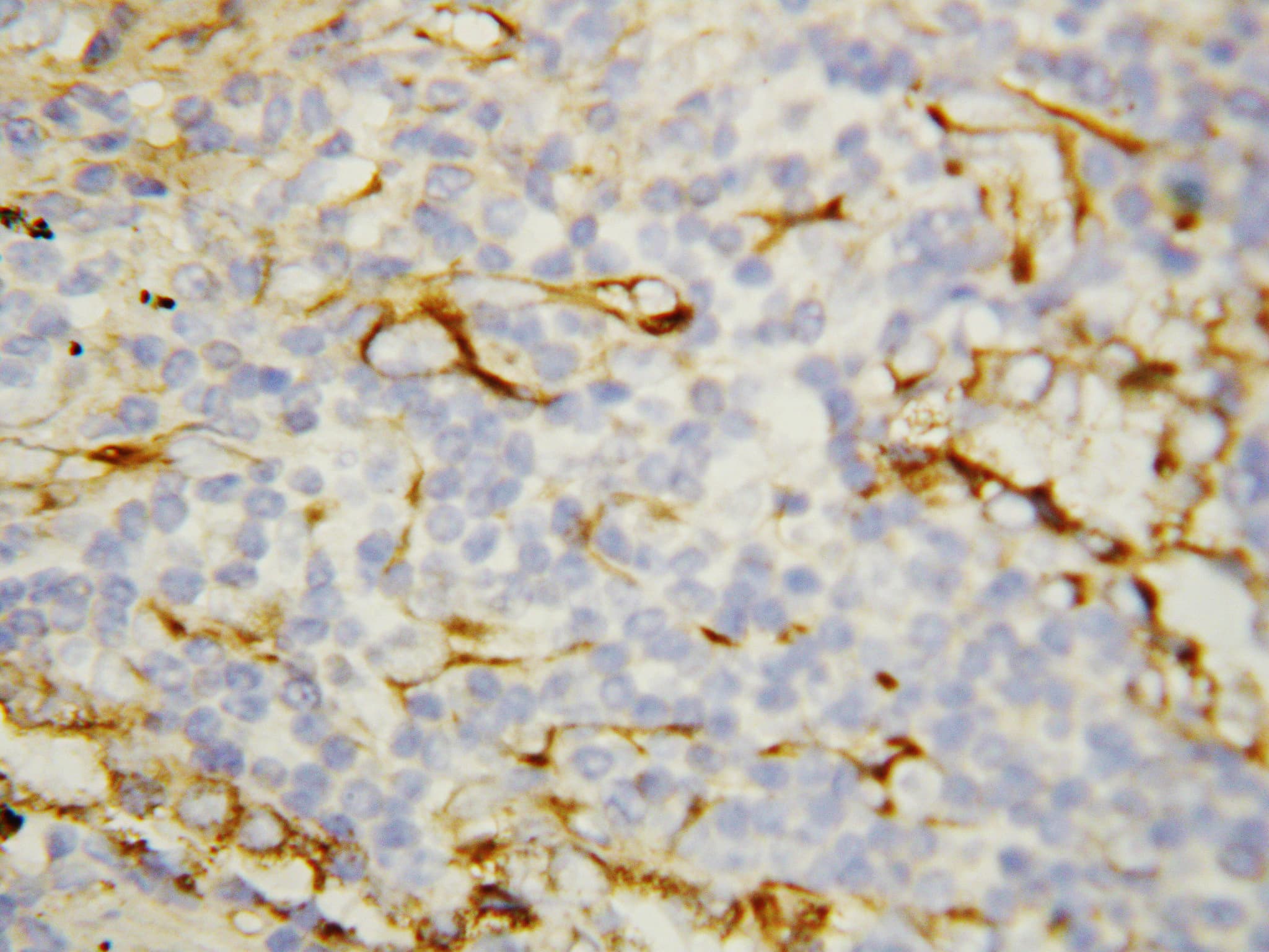FLT1 / VEGFR1 Antibody (aa1299-1317)