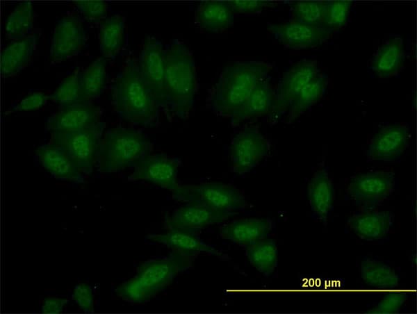IHC-plus™ Monoclonal Mouse anti-Human SETD7 / SET7 Antibody (clone 5B4, IHC, IF, WB)