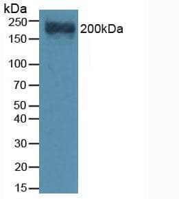 VCAN / Versican Antibody (aa3058-3299)