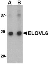 IHC-plus™ Polyclonal Rabbit anti-Human ELOVL6 Antibody (IHC, IF, WB)