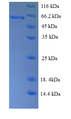 Human RGS7 Protein (Recombinant His)