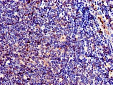 CD209 / DC-SIGN Antibody