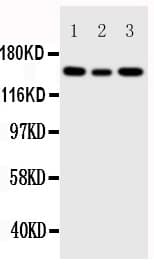 Polyclonal Rabbit anti-Human IGF1R / IGF1 Receptor Antibody (aa1353-1367, IHC, WB)