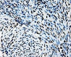 SORD / Sorbitol Dehydrogenase Antibody (clone OTI15H2)