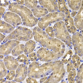 FKBP6 Antibody