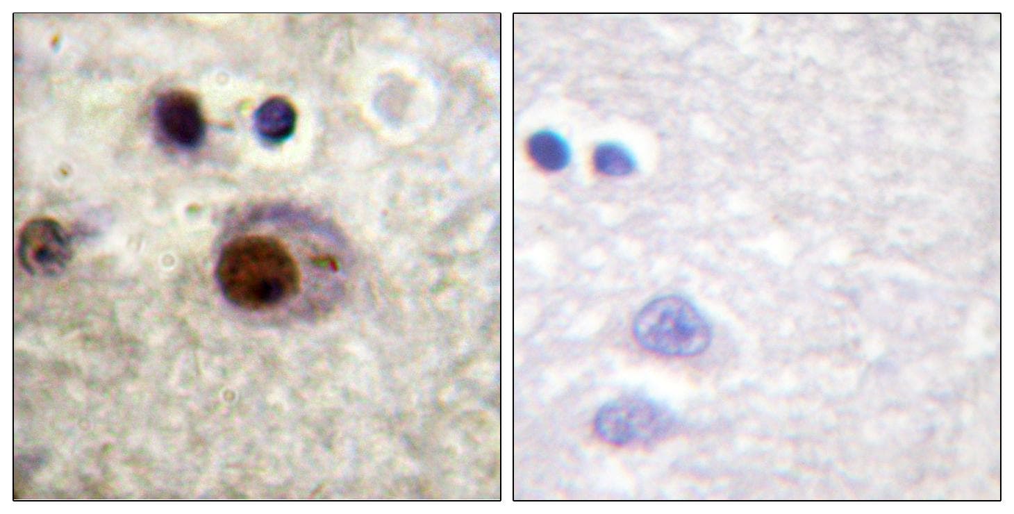 HNRNPC / HNRNP C Antibody (phospho-Ser260)