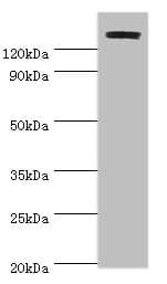 Polyclonal Rabbit anti-Human TP53BP2 / ASPP2 Antibody (aa360-600, WB)