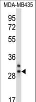 CELA2A / ELA2A Antibody (aa231-260)
