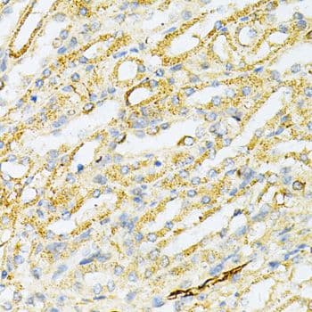 Polyclonal Rabbit anti-Human SULT2A1 / Sulfotransferase 2A1 Antibody (IHC, WB)