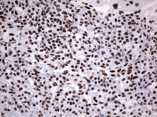 Monoclonal Mouse anti-Human PPP1R8 / Rnase E Antibody (clone OTI4E5, aa1-225, IHC, WB)
