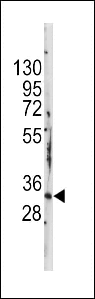 Polyclonal Rabbit anti-Human STAP1 / BRDG1 Antibody (aa41-70, IHC, WB)
