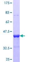 Human DES / Desmin Protein (Recombinant GST, N-terminus)