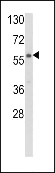 CARS2 Antibody (aa536-564)