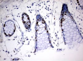 MKI67 / Ki67 Antibody (aa1160-1493, clone OTI8B11)