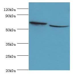 Polyclonal Rabbit anti-Human STXBP3 Antibody (aa343-592, IHC, WB)