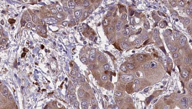 Polyclonal Rabbit anti-Human KCNE1 / MinK Antibody (IHC, IF, WB)