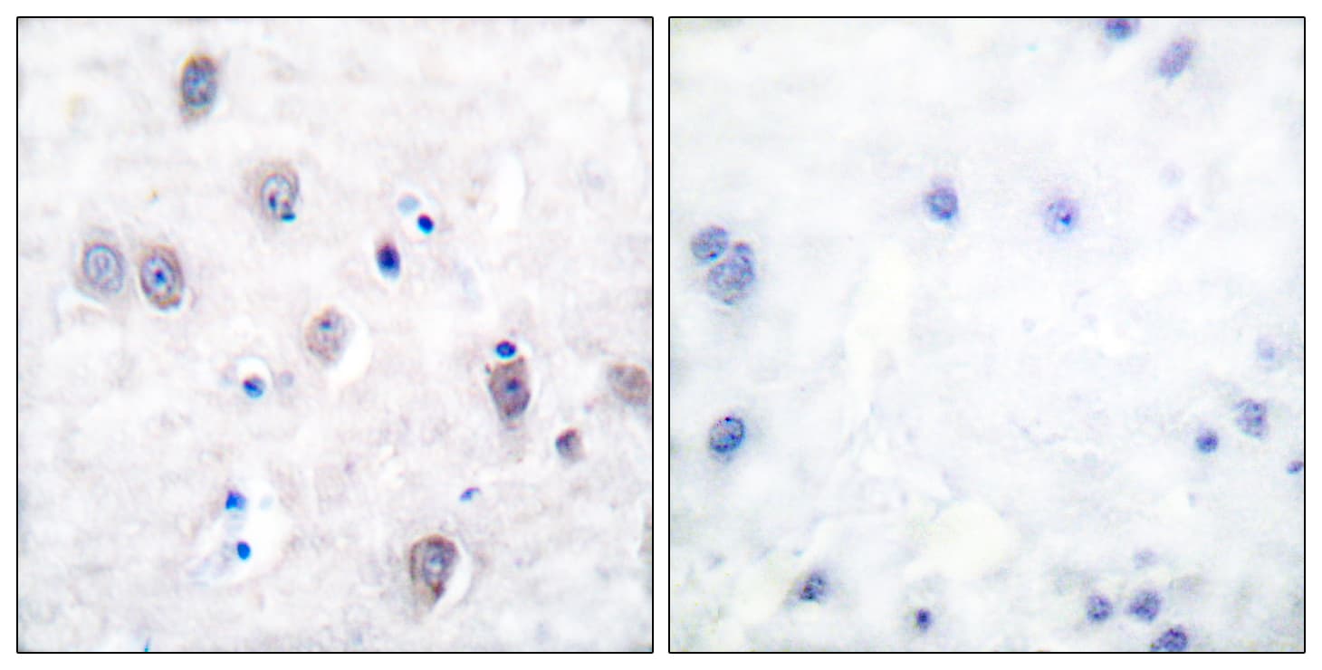 Polyclonal Rabbit anti-Human Beta Amyloid Antibody (aa711-760, IHC, IF, WB)