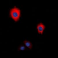 ZAP70 Antibody (C-Terminus)