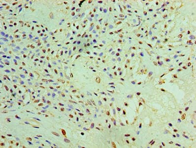 PYCR1 Antibody