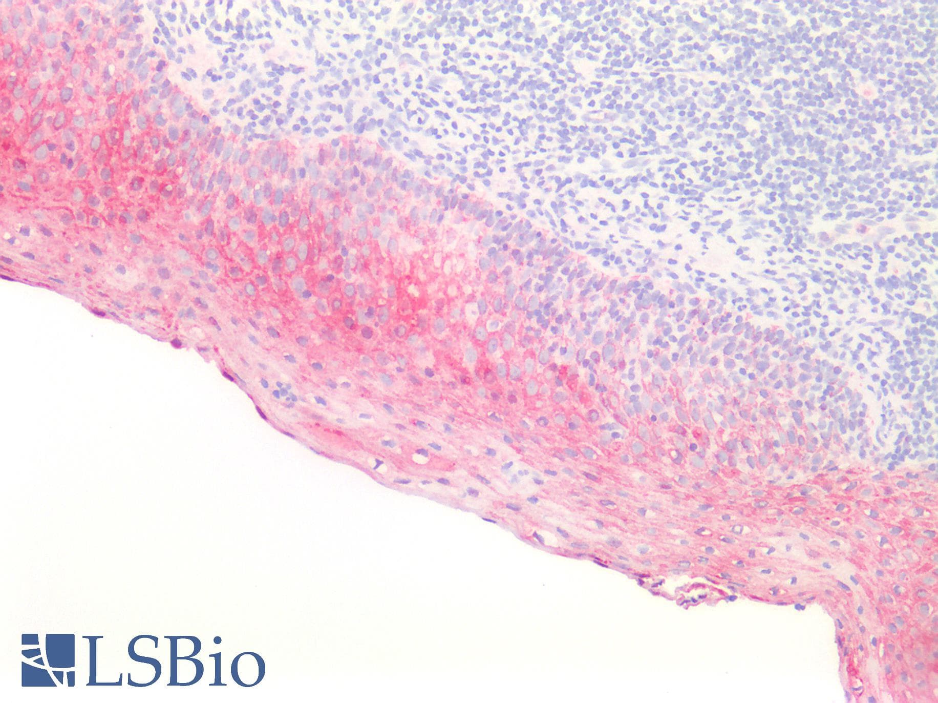 PathPlus™ Monoclonal Mouse anti-Human HSPB1 / HSP27 Antibody (IHC, WB)