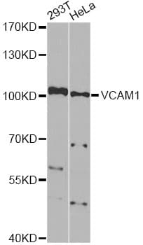 Polyclonal Rabbit anti-Human VCAM1 / CD106 Antibody (WB)