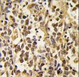 Polyclonal Rabbit anti-Human DNMT3A Antibody (aa457-486, IHC, WB)