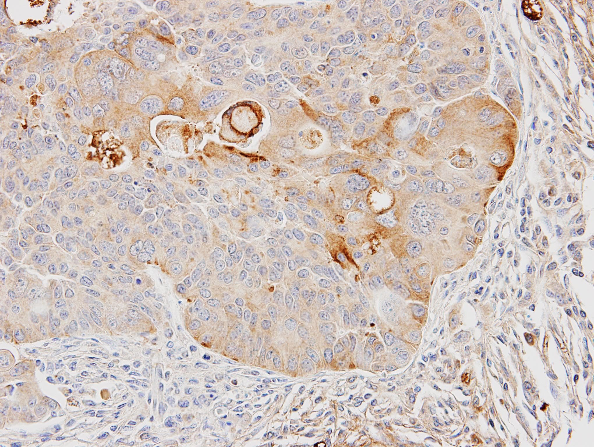 GSTA4 Antibody (aa1-222)