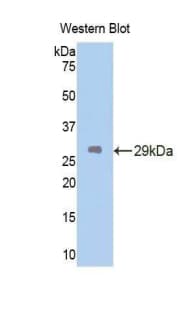 CETP Antibody (aa81-311, PE)