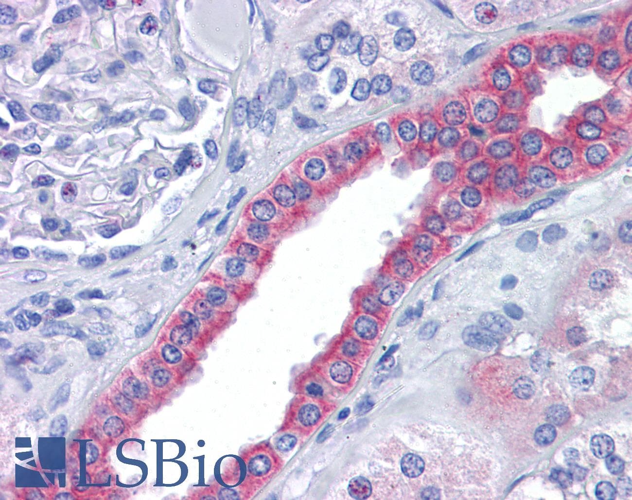 IHC-plus™ SKA2 Antibody