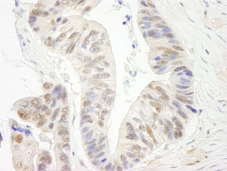 ERCC5 / XPG Antibody (aa650-700)