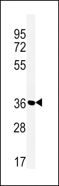 Polyclonal Rabbit anti-Human SLC25A28 Antibody (aa36-64, IHC, WB)