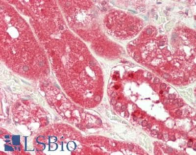 IHC-plus™ Monoclonal Mouse anti-Human LGALS9 / Galectin 9 Antibody (clone 21B5, IHC, WB)