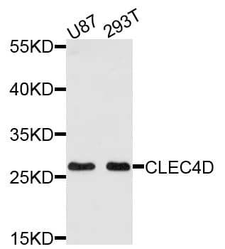Polyclonal Rabbit anti-Human CLEC4D / MCL Antibody (IHC, WB)