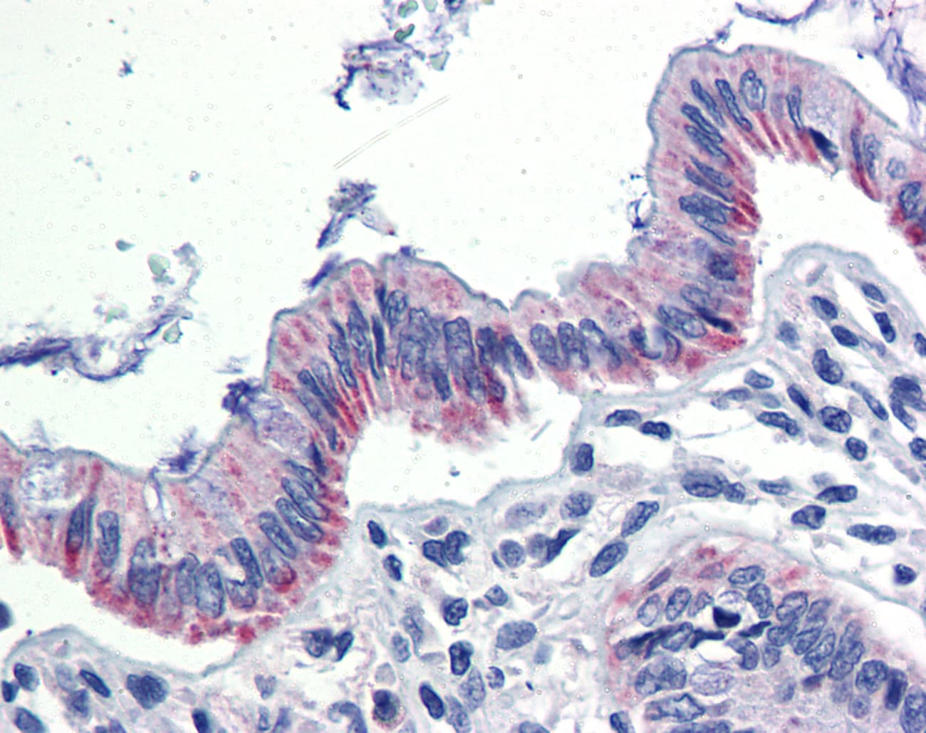 PathPlus™ EGR2 Antibody (aa397-446)