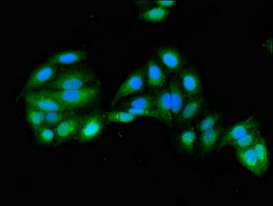 GRHPR / Glyoxylate Reductase Antibody
