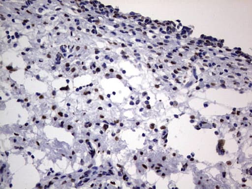 HNRNPL / hnRNP L Antibody (aa270-502, clone OTI2E4)