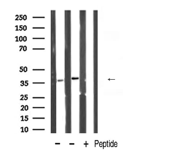 Polyclonal Rabbit anti-Human POLB / DNA Polymerase Beta Antibody (IHC, IF, WB)