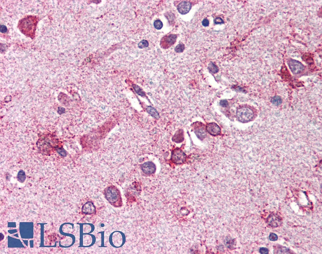 IHC-plus™ MLST8 / GBL Antibody